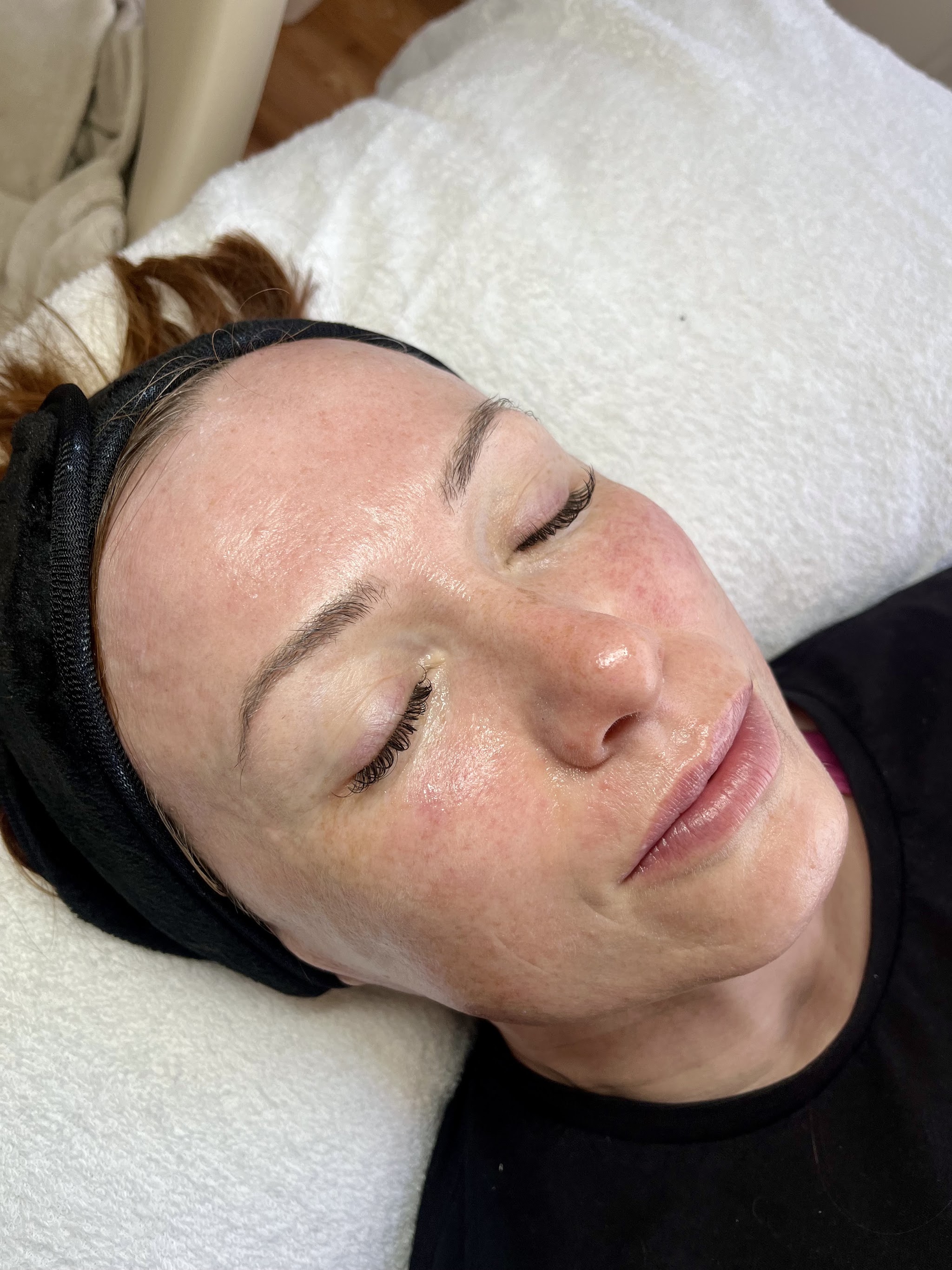 A client relaxing after a skin treatment